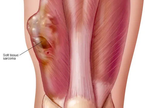 Bone & Soft Tissue