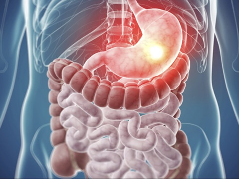 Gastrointestinal Cancer