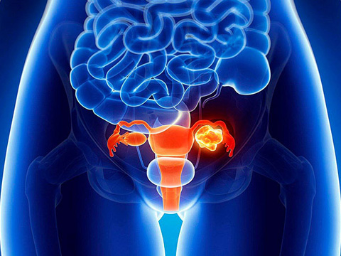 Urological Cancer